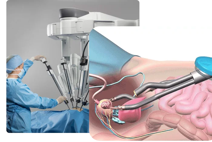 Robotic Prostatectomy Surgery in Ahmedabad